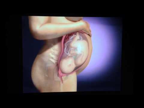 Thumbnail for Mecanismos del trabajo de parto